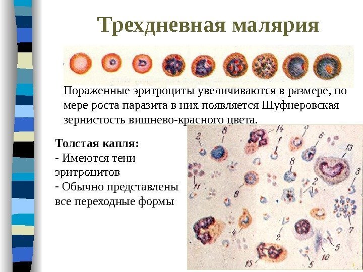 Лабораторная диагностика малярии